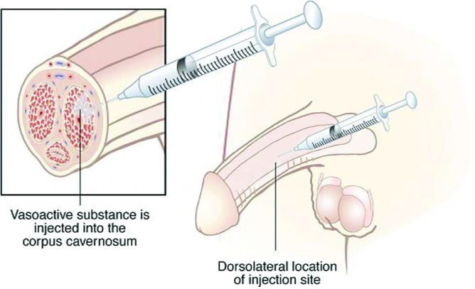 www.excelmale.com